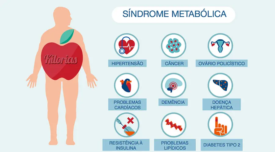Síndrome Metabólica (SM) e Risco Cardiovascular